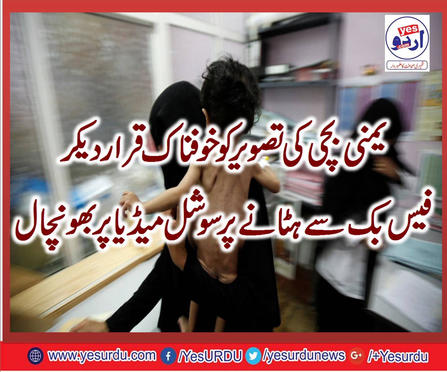 کیمیائی ہتھیاروں سے متاثرہ یمنی بچی کی تصاویر ہٹانے پر صارفین نے فیس بک انتظامیہ کو ہلا کر رکھ دیا