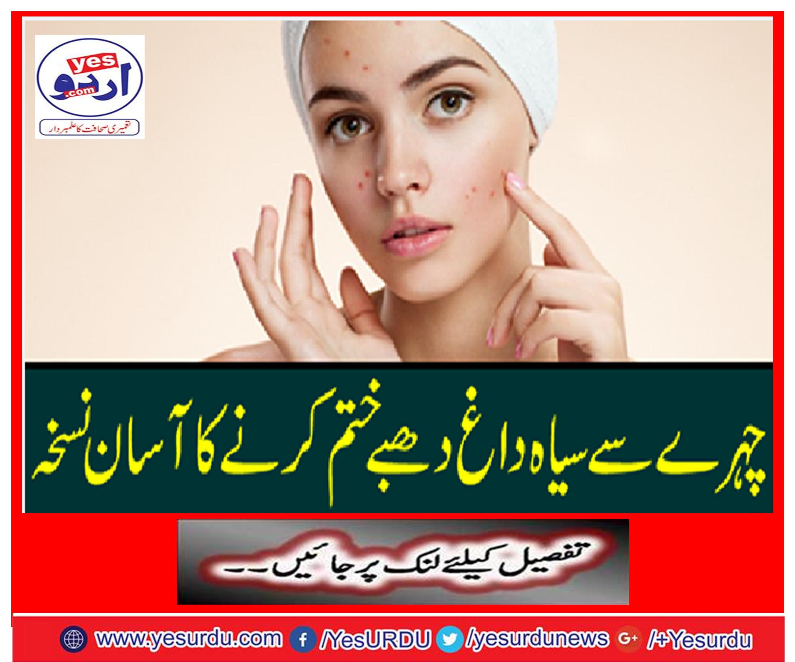 Easy to remove black spots from face to face