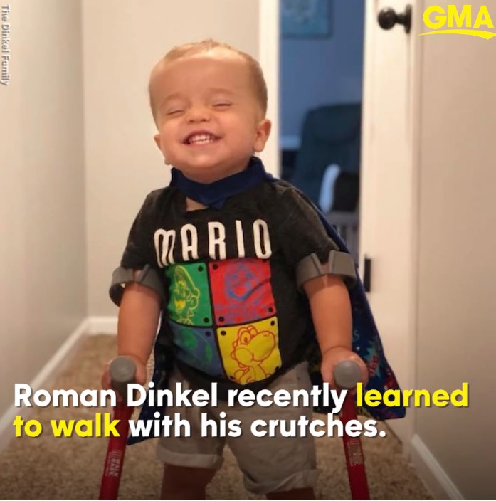 Toddler, with, spina, bifida, warms, hearts, after, showing, the, world, he, can, walk , I’m, not, crying!, I’m, actually, sobbing, happy, tears!, How, adorable, is, he!, God, has, truly, blessed, us, with, you!!