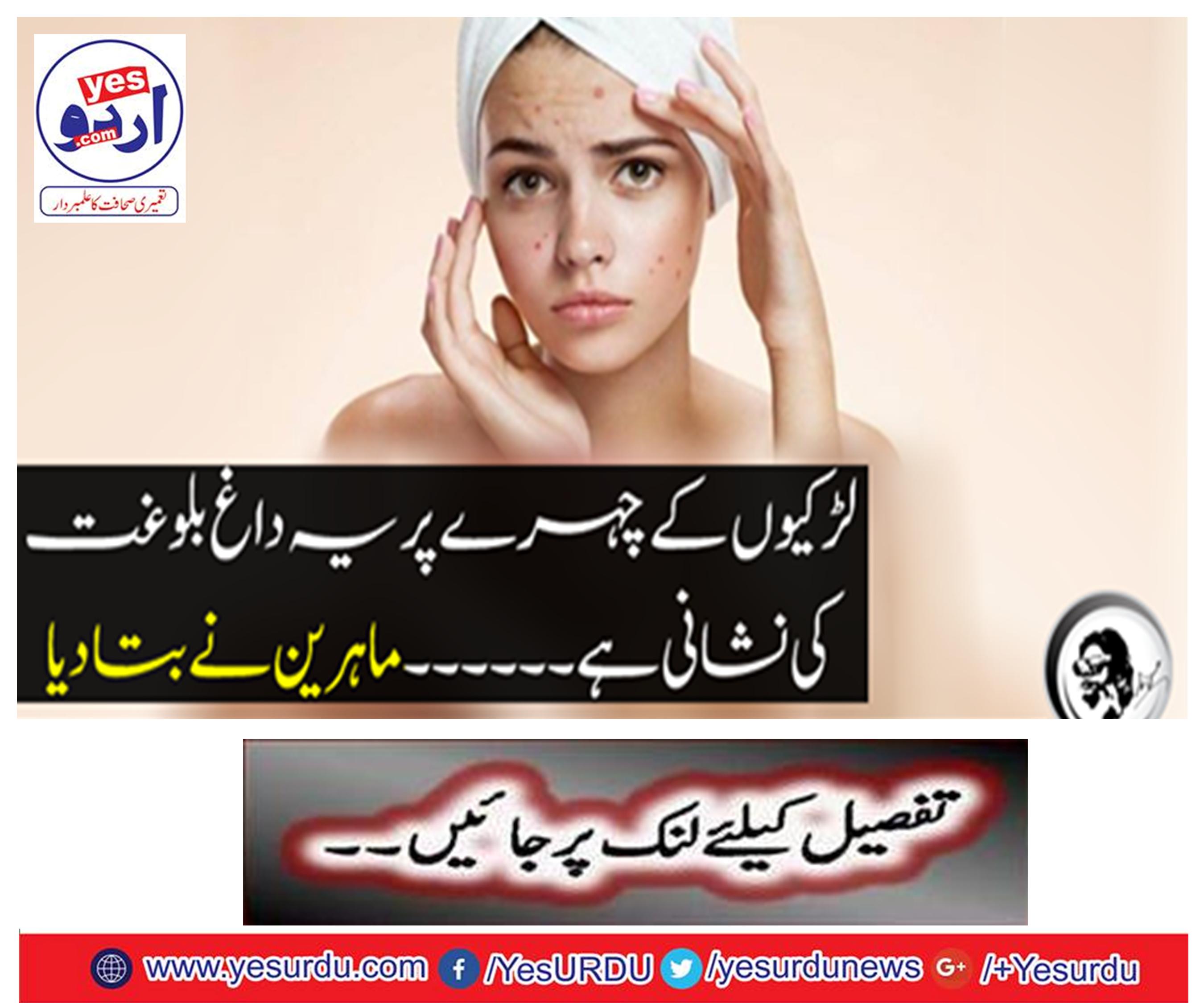 This is a sign of puberty on the face of girls .... experts told