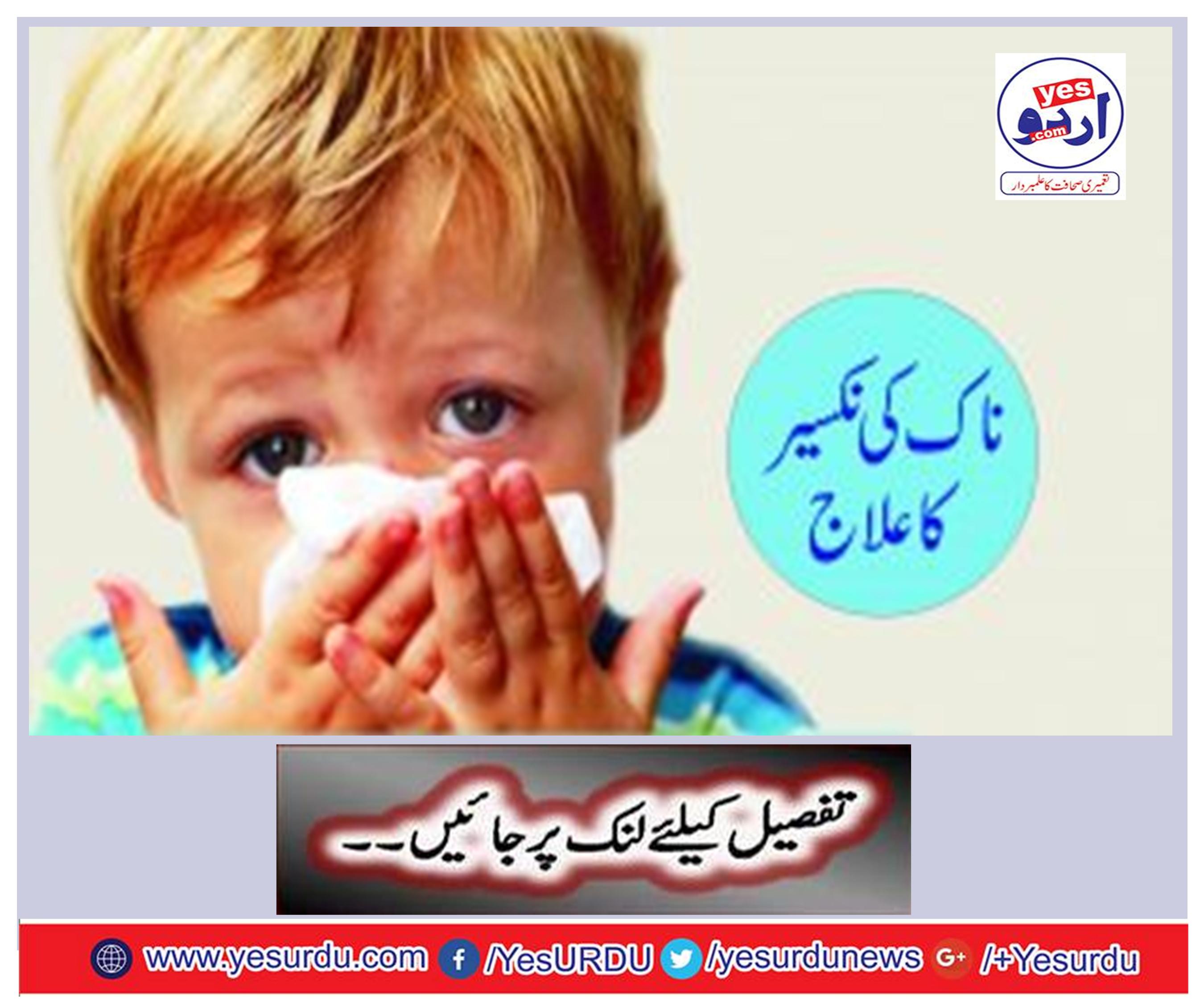 Treatment of nose Nixer