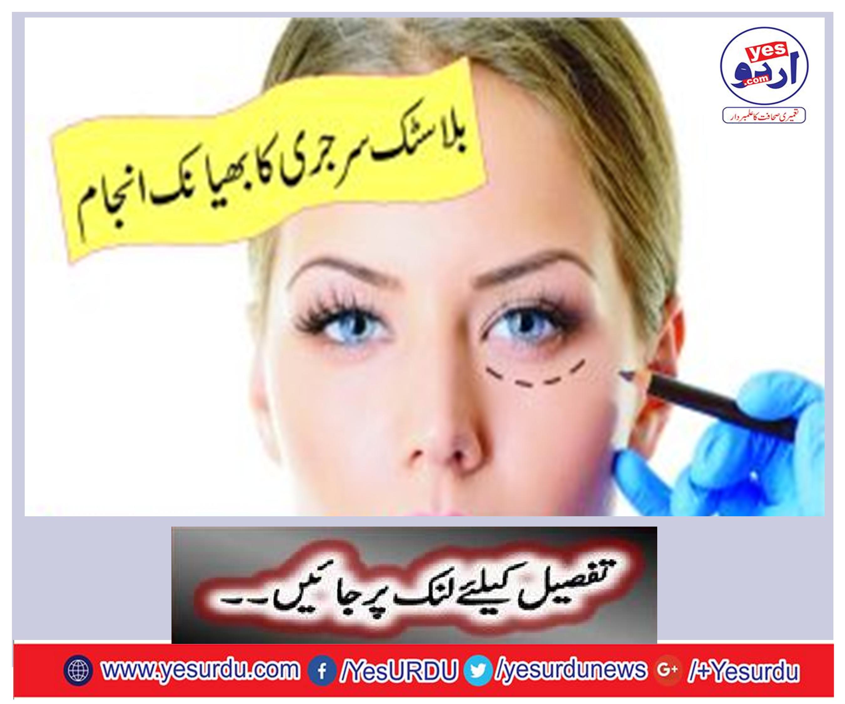 Sudden breakthrough of plastic surgery