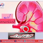 Kidneys and therapeutic causes