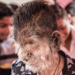 a, child, in, indian, state, madiha pardesh, who, have, full, hair, on, his, mouth