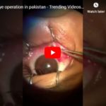 Eye operation in pakistan