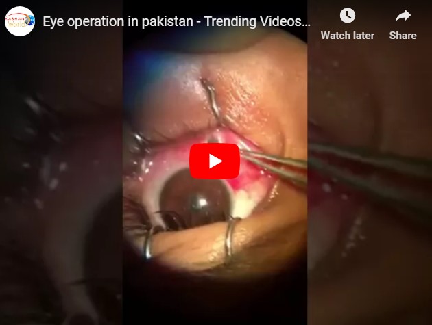 Eye operation in pakistan