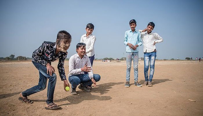 a, child, in, indian, state, madiha pardesh, who, have, full, hair, on, his, mouth