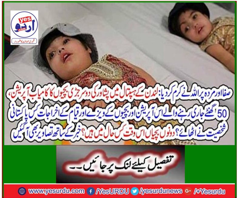 Successful operation of Peshawar's two head-headed children in London's hospital