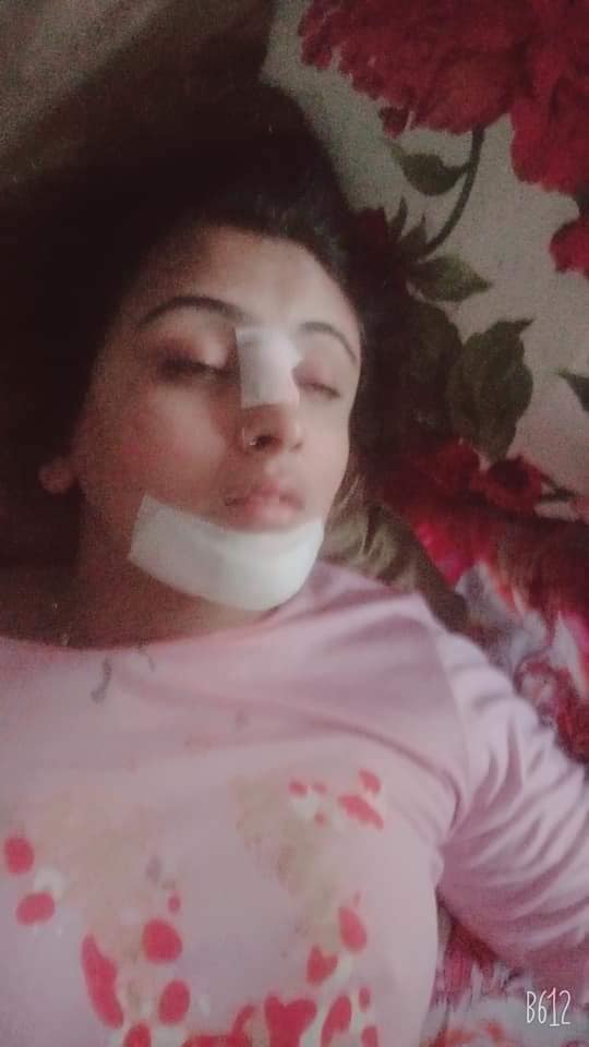STAGE, ACTRESS, SANA SHEHZADI, GOT, SERIOUS, ACCIDENT, AND, INJURED, BADLY