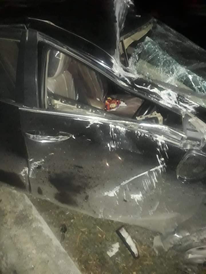 STAGE, ACTRESS, SANA SHEHZADI, GOT, SERIOUS, ACCIDENT, AND, INJURED, BADLY