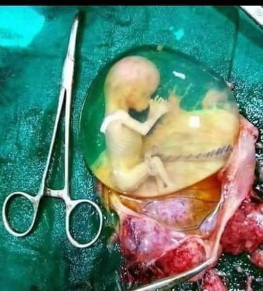 a, teen ager, girl, sex, with, boyfriend, and, got, pregnant, she, came, to, lady doctor, for check up